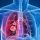 The signs and symptoms of lung cancer